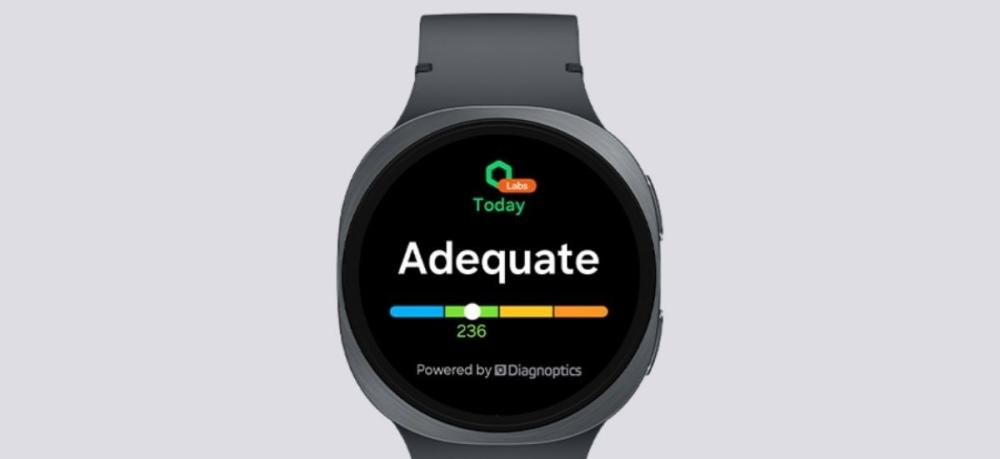 Ceasul Samsung Galaxy Watch8 40mm urmărește nivelul AGE și oferă recomandări.